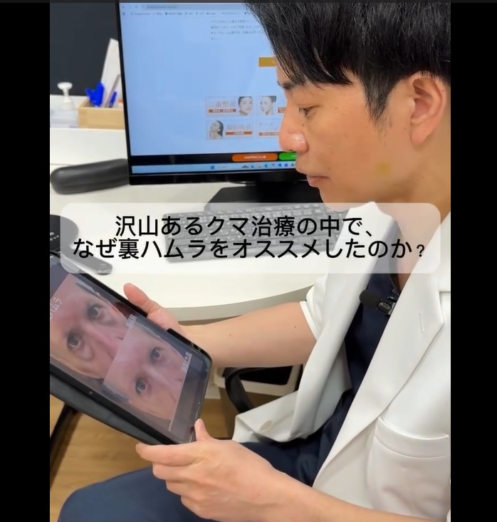 クマ取り治療で裏ハムラ法をお勧めする理由のメイン画像