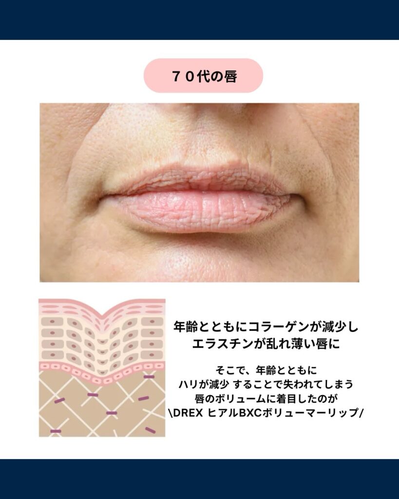 70代の唇