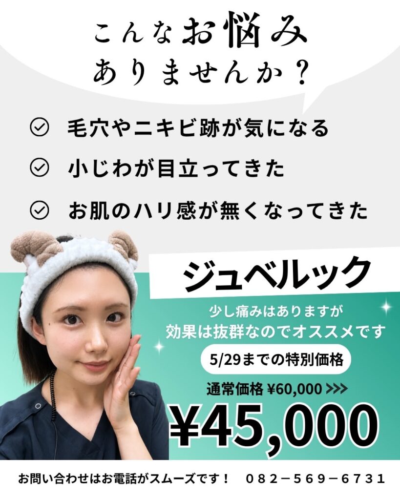 ジュベルック
