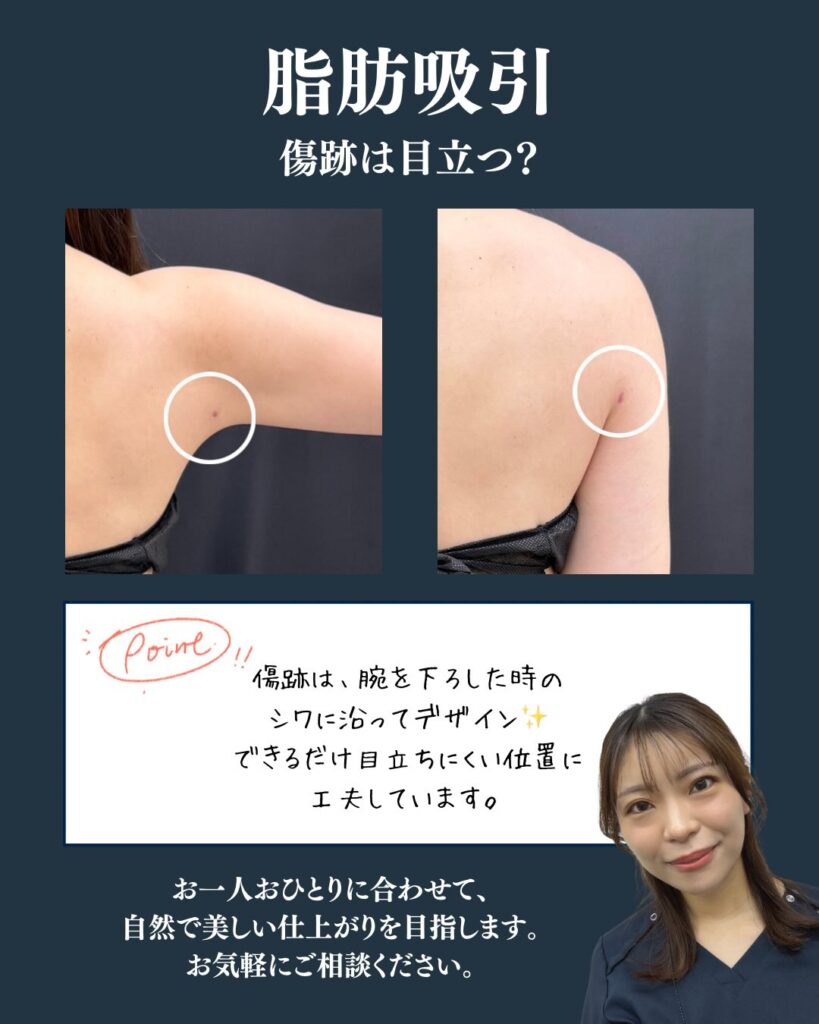 傷跡