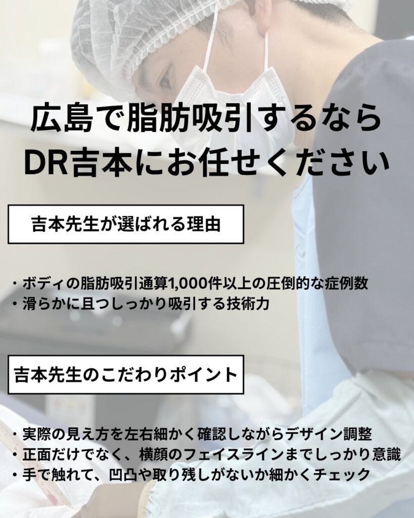 脂肪吸引担当吉本医師