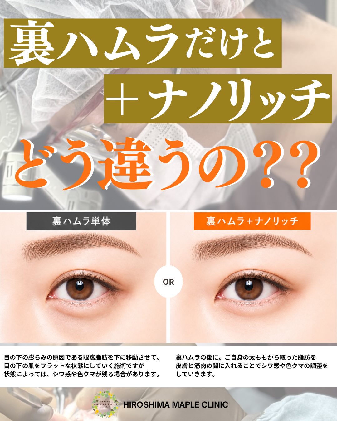 裏ハムラだけ？＋ナノリッチ？どう違うの？のメイン画像