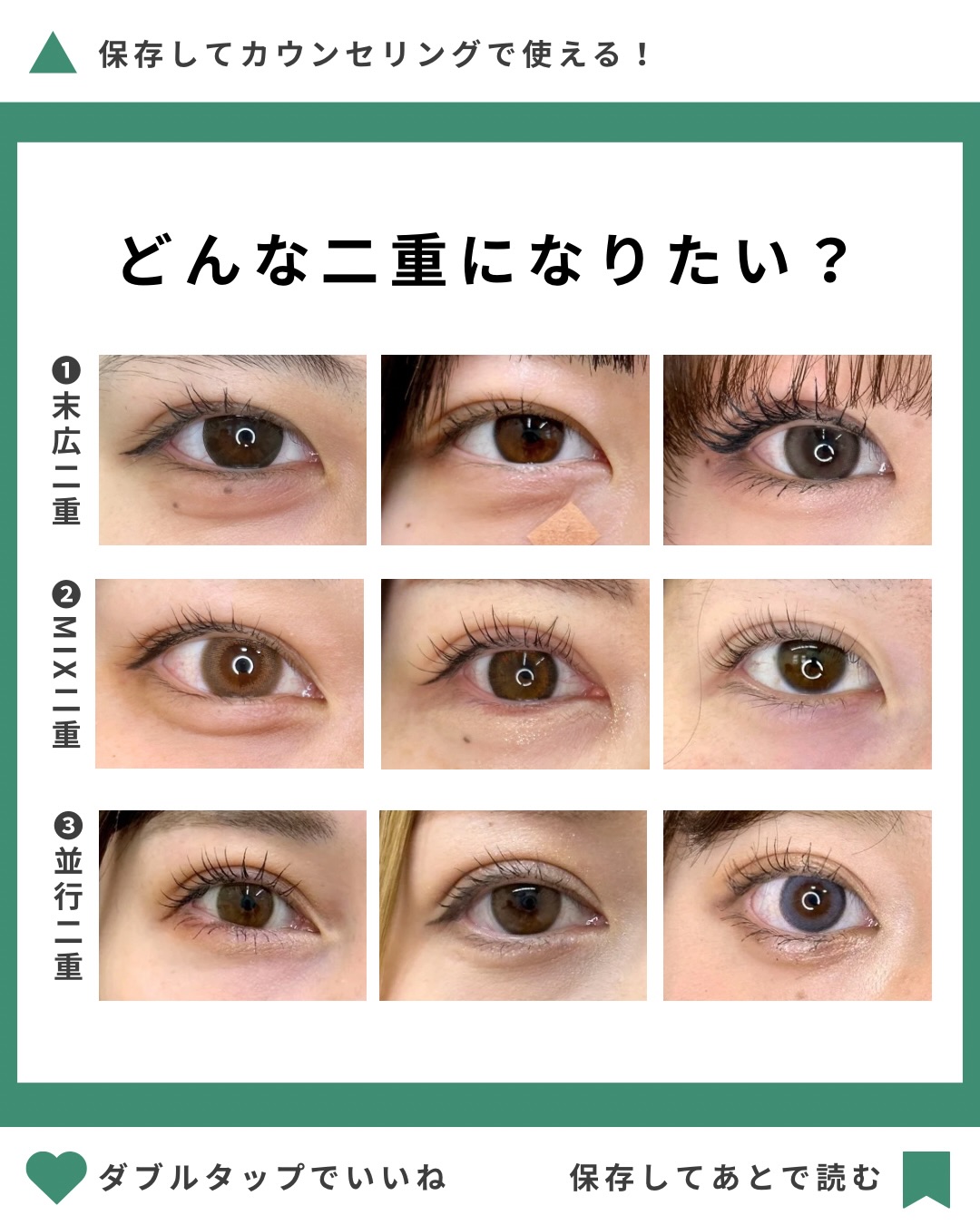 二重埋没法のデザインについてのメイン画像