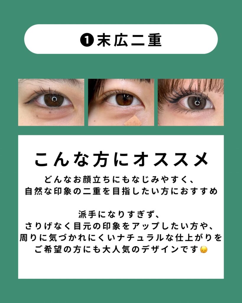 末広二重