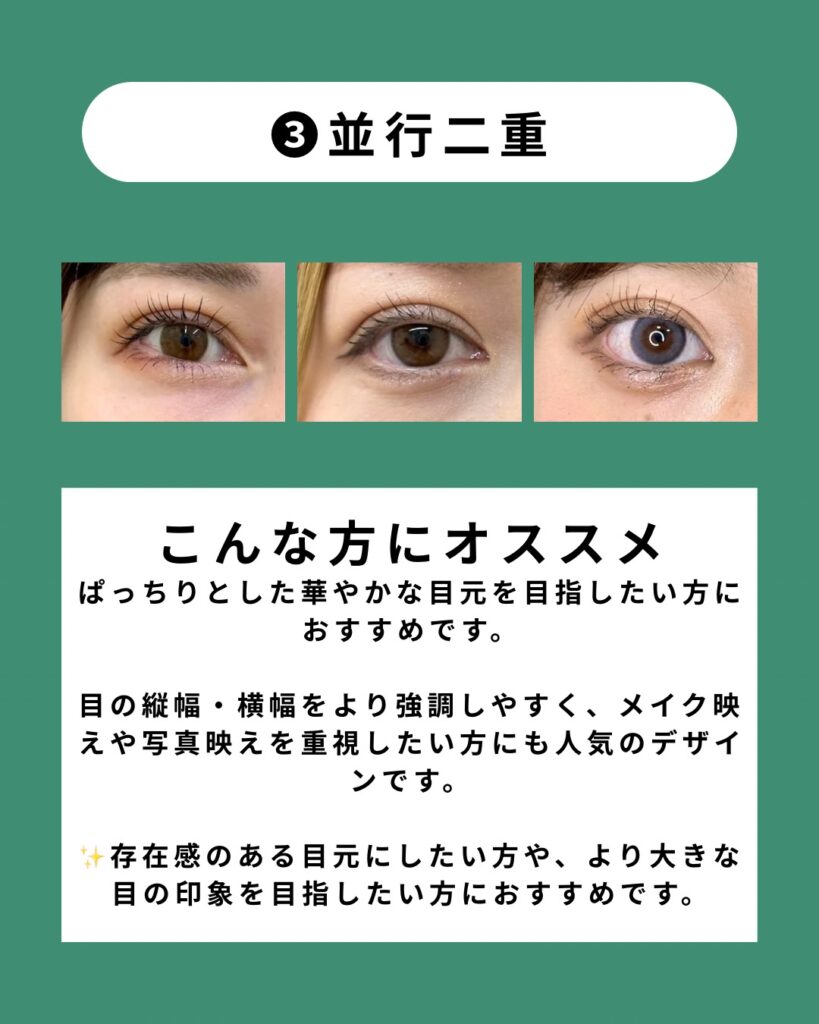 並行二重