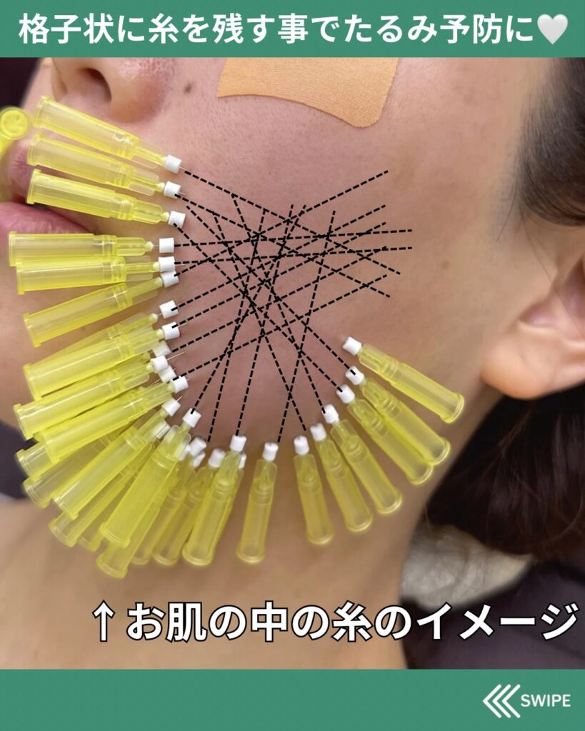 糸のイメージ