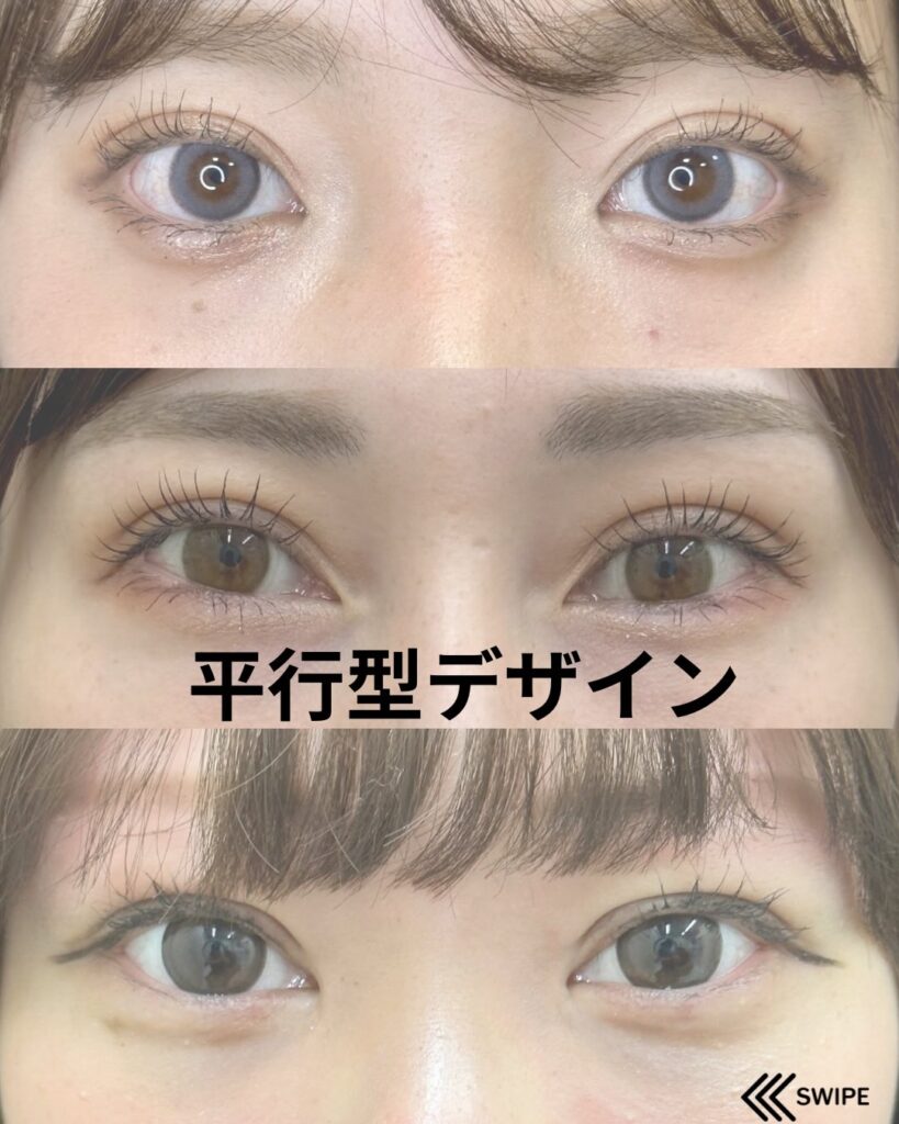 平行型デザイン