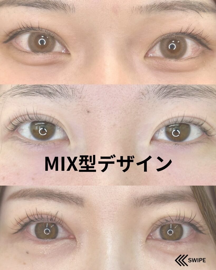 MIX型デザイン