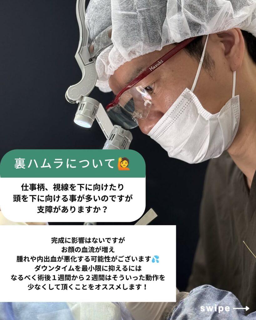 裏ハムラについて