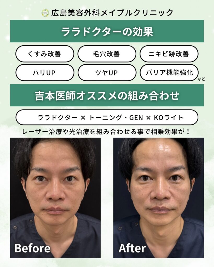 ララドクターについて