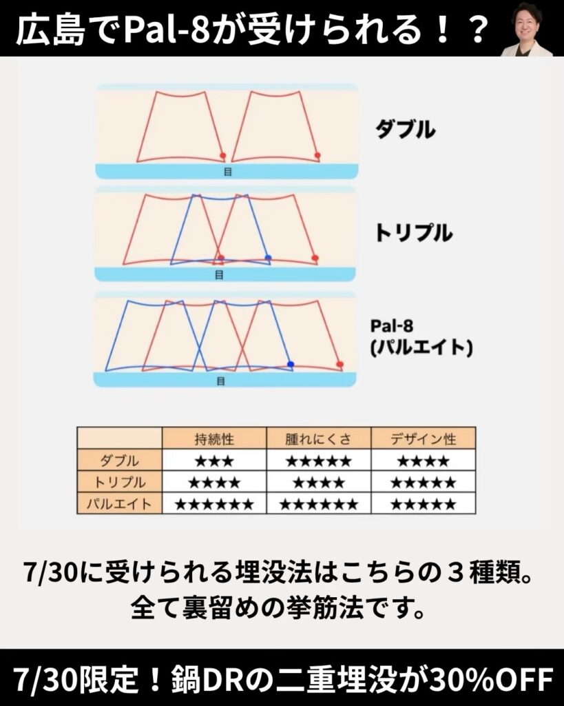埋没法について